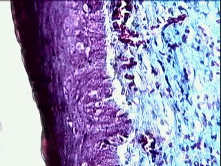 Imagen de Efecto del Acido Hialuronico en la Cicatrizacin de Heridas en Ratas.