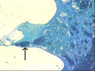 Imagen de Densidad neuronal en ganglio espiral de ratas sordas. Estudio preliminar.