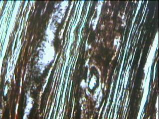 Imagen de Biopsias de nervio perifrico. Experiencia en el Instituto de Neurologa y Neurociruga de La Habana