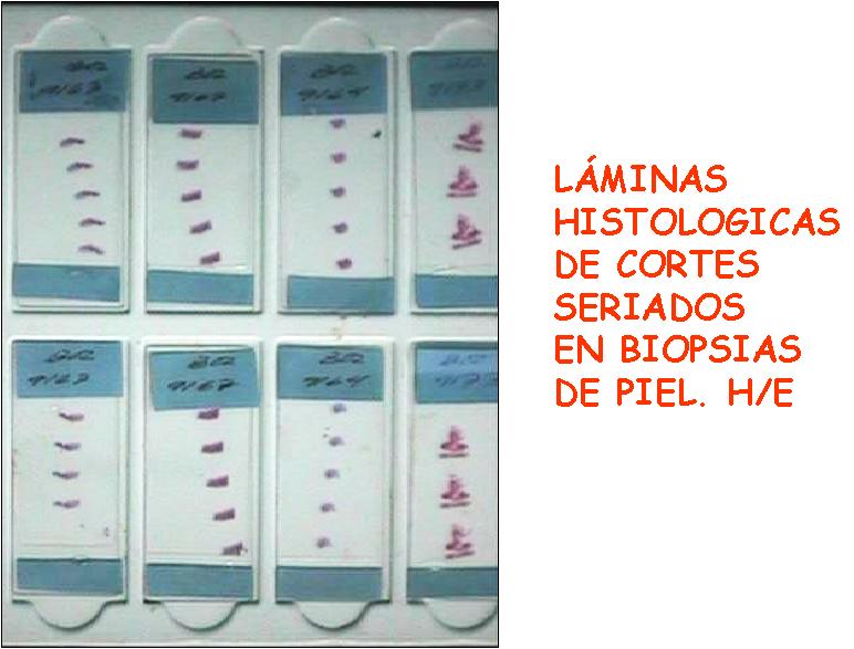 Imagen de Resultado del Trabajo realizado en la Sección de Coloraciones Especiales relacionadas con la Patología Dermatológica durante el año 2003