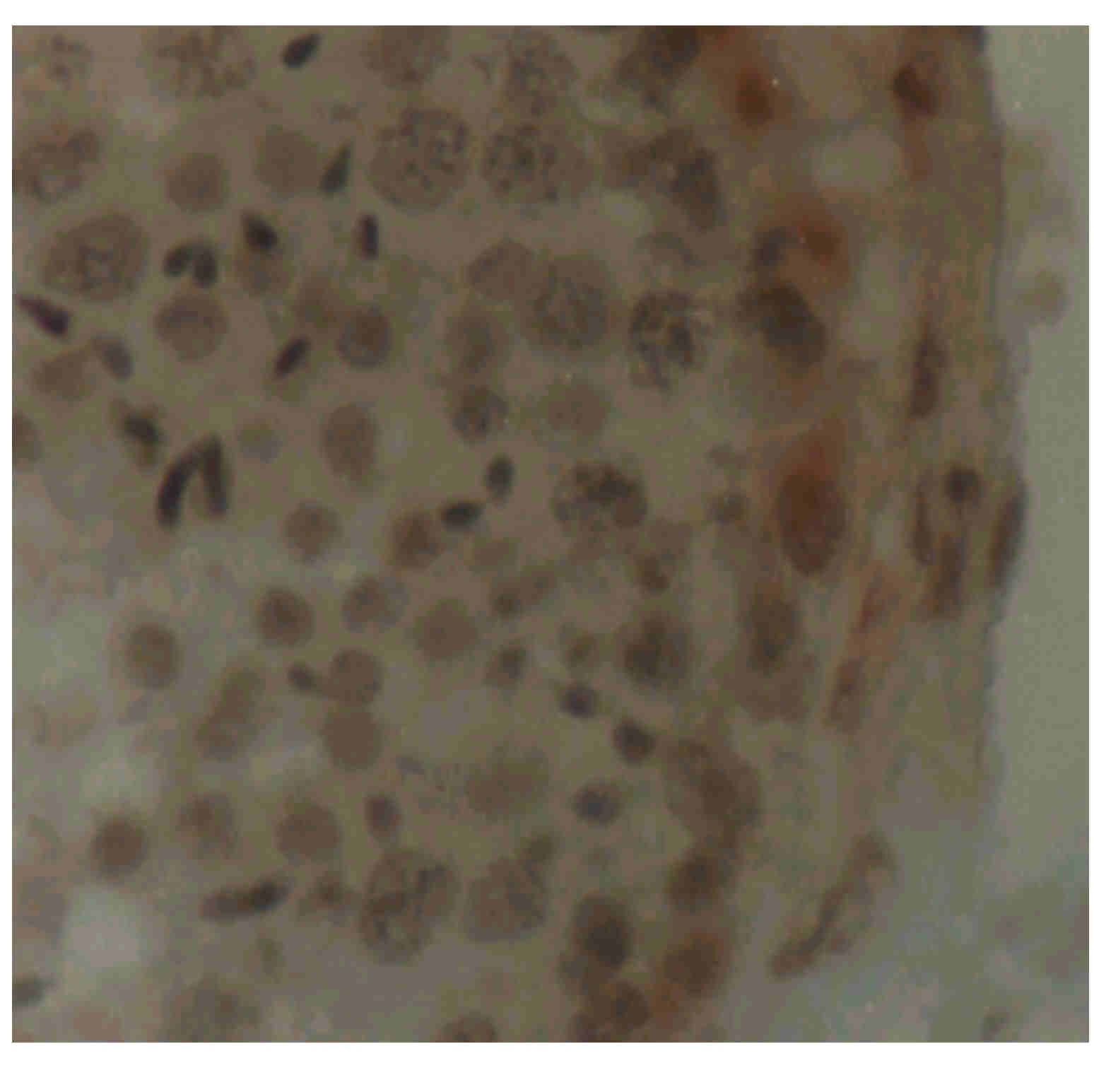 Imagen de Inmunoreactividad de enolasa en el epitelio seminífero senil humano.