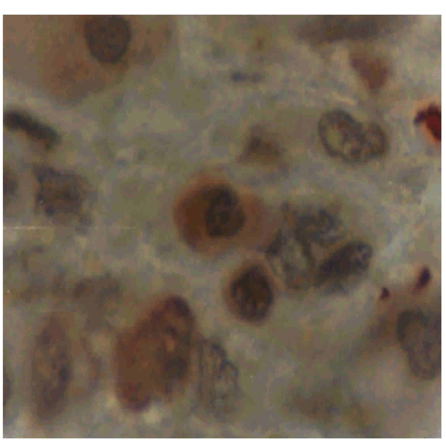Imagen de Inmunoreactividad de enolasa en el epitelio seminífero senil humano.
