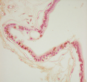 Imagen de Apoptosis y Proliferacin Celular en Lesiones Pretumorales en Prstata Ventral de Ratas Tratadas con Cloruro de Cadmio