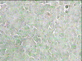 Imagen de Induccin de apoptosis y efecto antiangiognico del preparado vacunal 1E10/Al en el modelo tumoral de Lewis 3LL-D122.