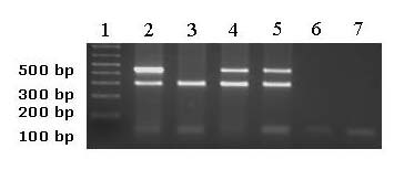 Imagen de Deleciones homozigticas y expresin de PTEN y DMBT1 en neuroblastomas primarios y lneas celulares