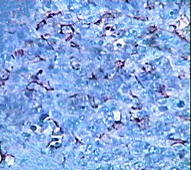 Imagen de Induccin de apoptosis y efecto antiangiognico del preparado vacunal 1E10/Al en el modelo tumoral de Lewis 3LL-D122.