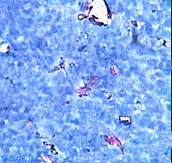 Imagen de Induccin de apoptosis y efecto antiangiognico del preparado vacunal 1E10/Al en el modelo tumoral de Lewis 3LL-D122.