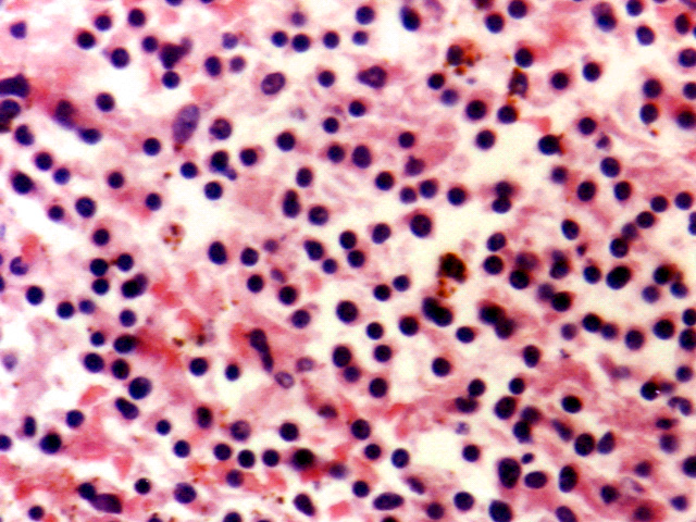 Fig. 5: Esplenectomia, vista a gran aumento. H-E - <div style=