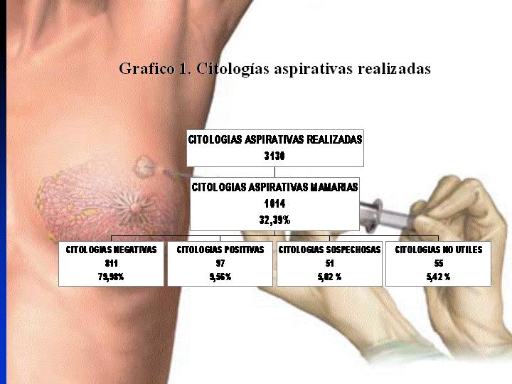 Grafico 1. Citologas aspirativas realizadas - <div style=