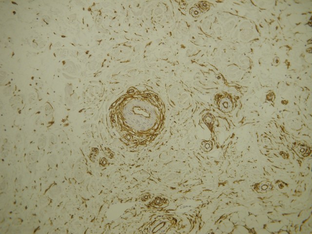 INMUNOHISTOQUIMICA - <div style=