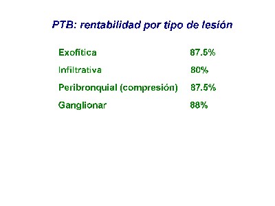 tabla II - <div style=