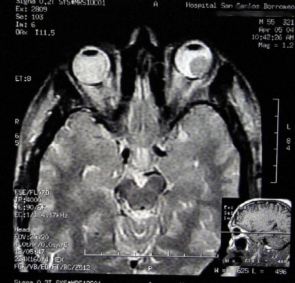 Fig.2 - <div style=