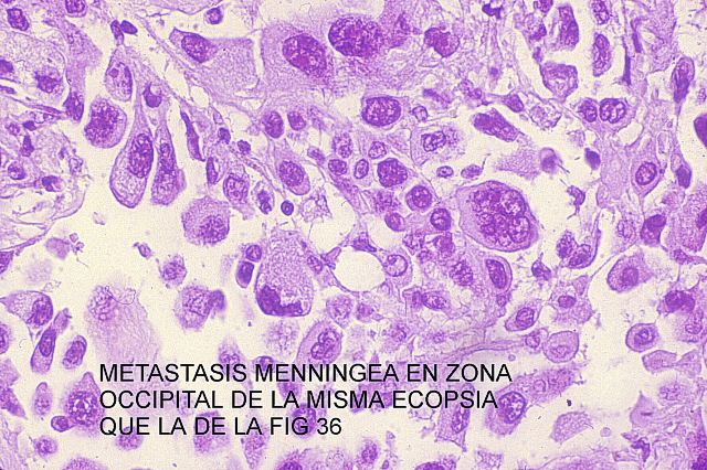 Figura 37.