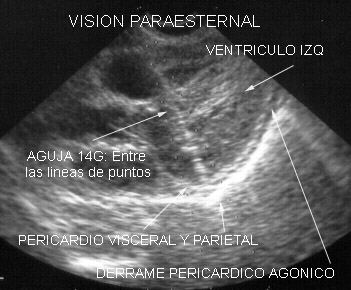 Figura 50.