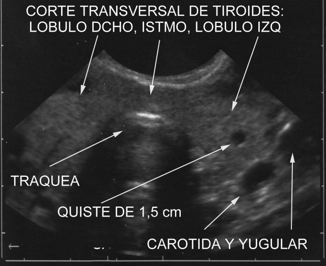 Figura 12.