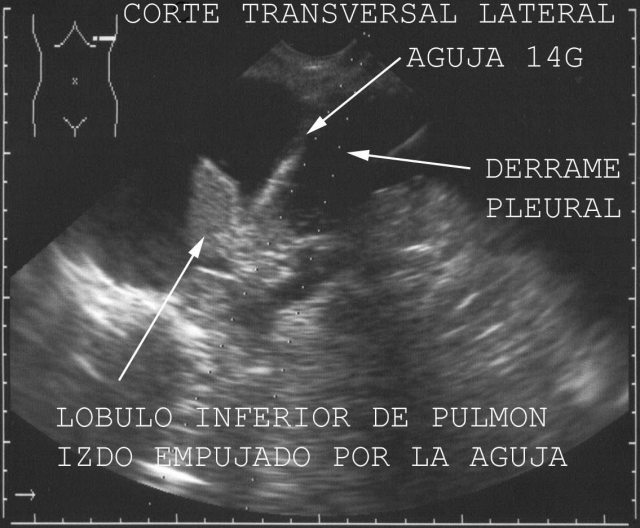 Figura 26.