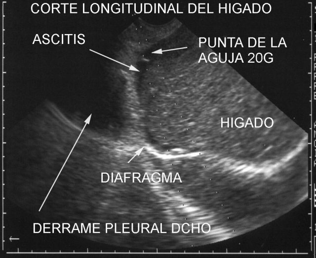 Figura 45.