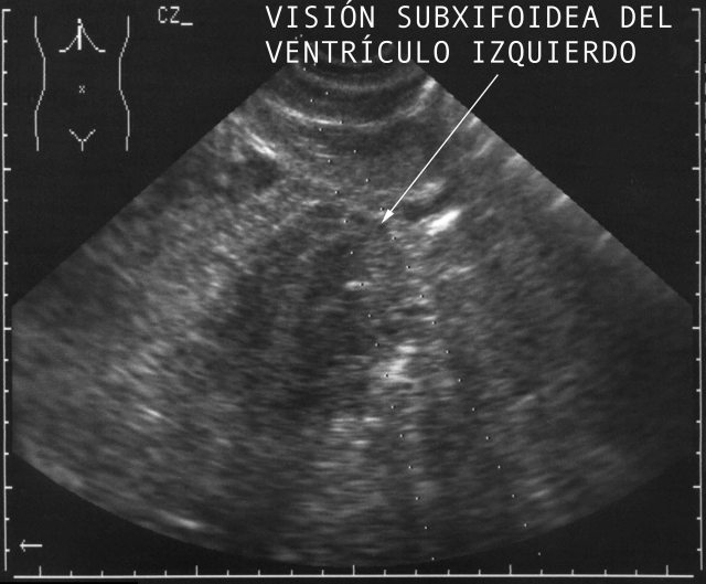 Fig. 46-47 - <div style=