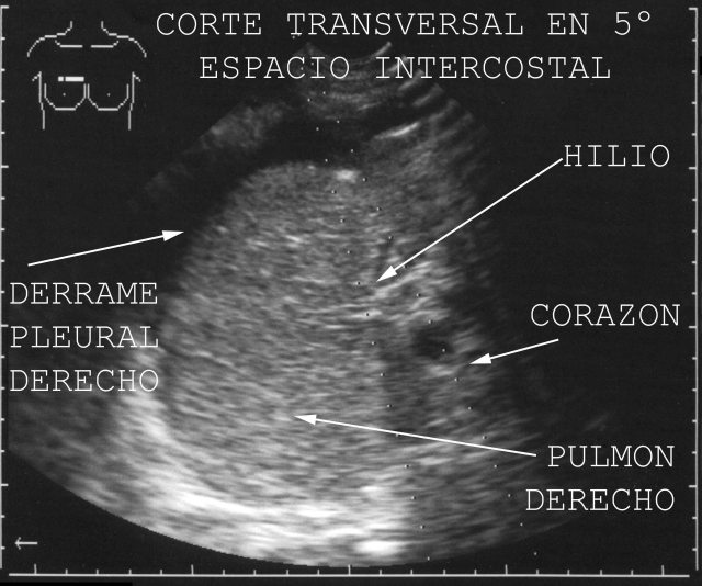 Figura 51.