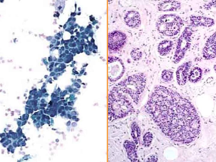 papilomatosis - <div style=