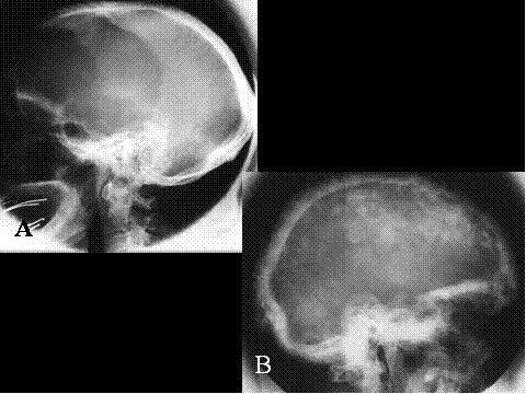 Fig-59 - <div style=