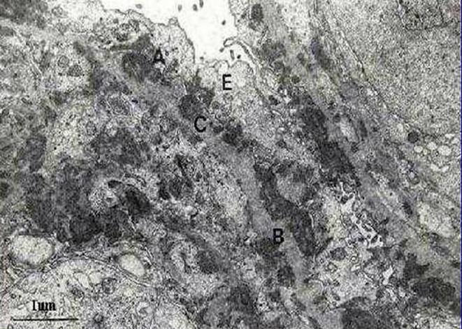 Microscopa Electrnica de Transmisin - <div style=