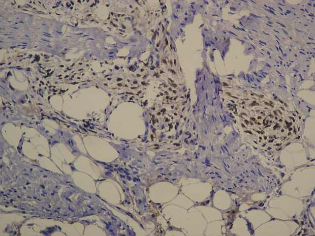 Fig.18 Bcl-2