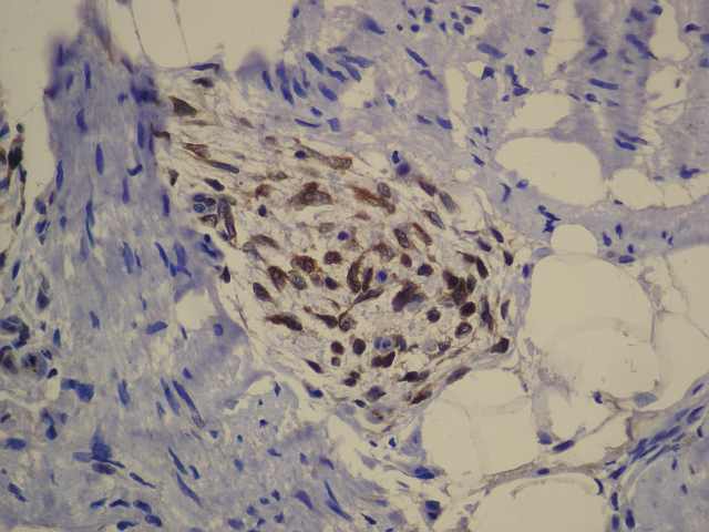 Fig.19 Bcl-2