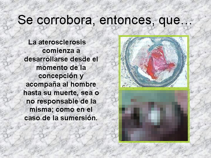 Aterosclerosis y muerte violenta - <div style=