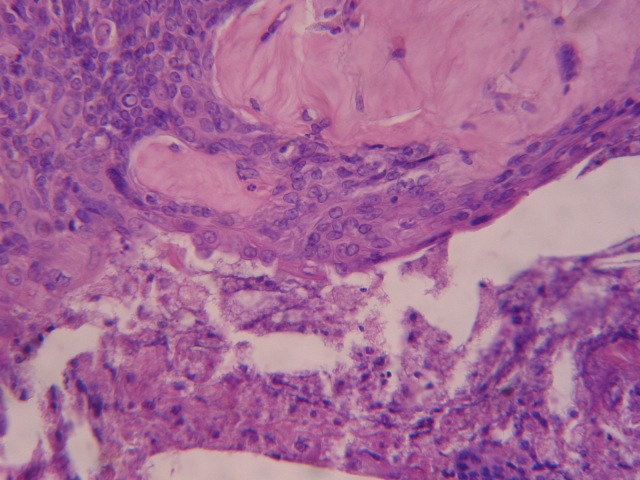 FIGURA 3. IMAGEN HISTOLOGICA - <div style=