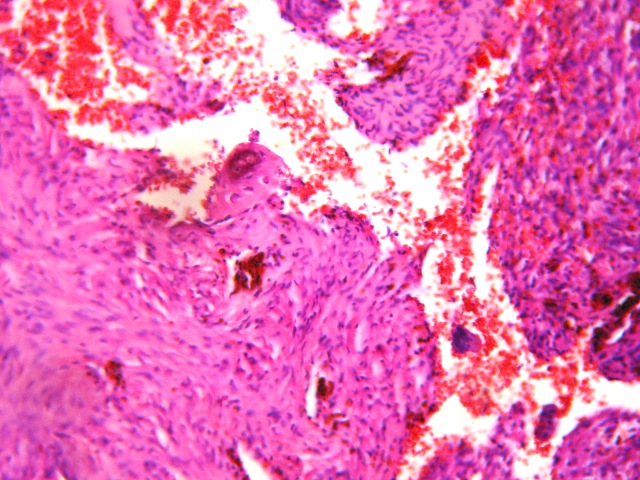 FIGURA 3. IMAGEN HISTOLOGICA - <div style=