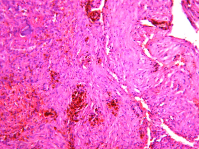 FIGURA 4. IMAGEN HISTOLOGICA - <div style=