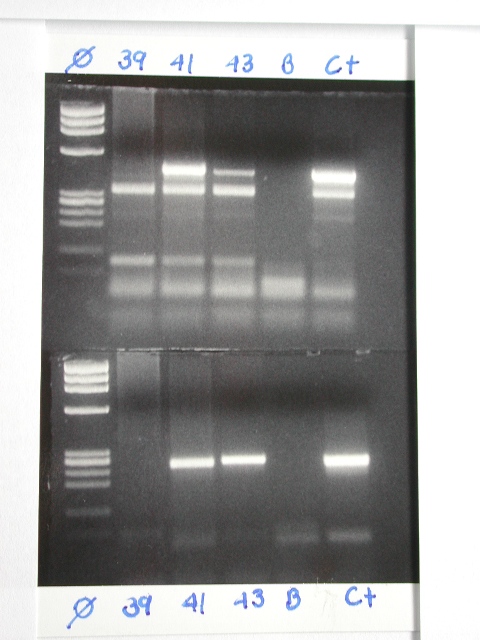 FIG. 3. Gel de agarosa 2%. Regiones MY-L1C1. Positivo 41 43, derecha C+ para MY (450pb). Positivo 41 43, derecha C+ para L1C1 (261pb).