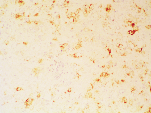 Inmunohistoquimia - <div style=