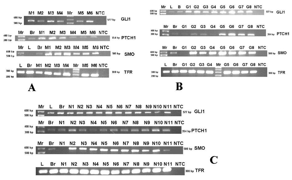 Figura 1 - Expresin de RNA comparativa de PTCH, SMO y GLI1 determinada mediante RT-PCR standard (A-C) y qRT-PCR (D-G). M: meduloblastoma, N: neuroblastoma, G: glioblastoma, L: RNA de pulmn, Br: RNA normal de cerebro adulto, NTC: control sin DNA, Mr: 1 Kb Plus DNA ladder (Invitrogen Life Technologies, Carlsbad, CA).