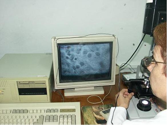 Figura 1. Computer Asisted MorfhoStereologic System Using Digital Image