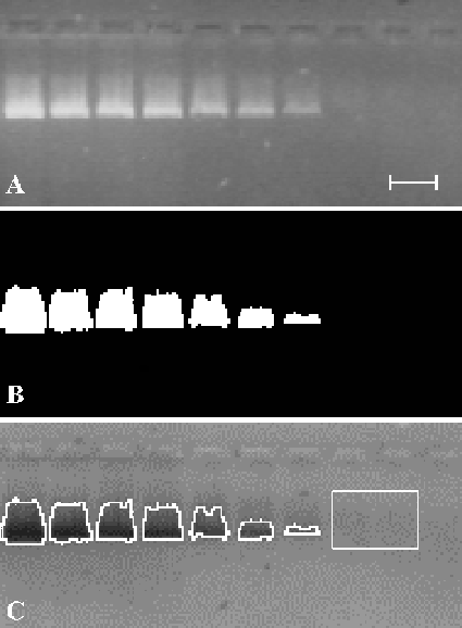 Cuantificacin por Anlisis de Imagen del Gel 