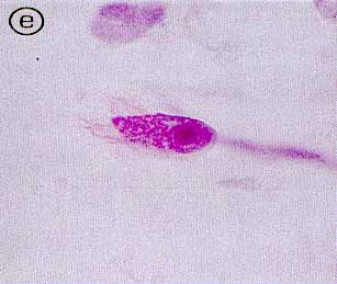 fig. 1e