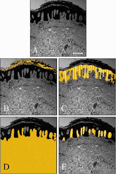 �reas Histol�gicas Cuantificadas por An�lisis de Imagen