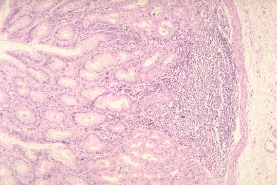 FOTO86.JPG (61093 bytes)