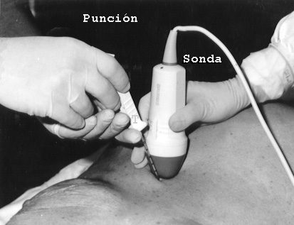 01PUNCIO.JPG (38080 bytes)