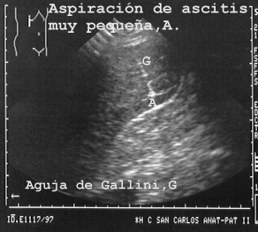 03ASPASC.JPG (33434 bytes)