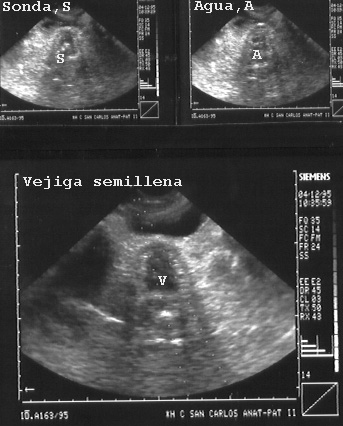 34AGUAVE.JPG (54538 bytes)