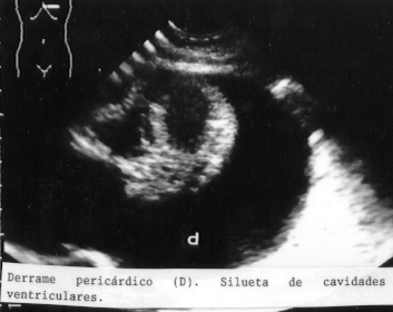 55CORDER.JPG (28700 bytes)