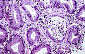 17.JPG (21699 bytes)