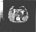 CT-Scan