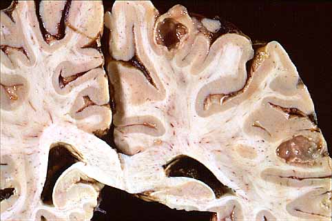 Macroscpica cerebro