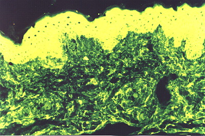 Fig. 4.- PPN Inmunofluorescencia.