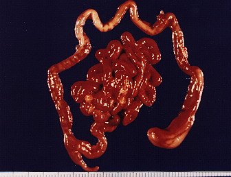 Fig.- 3 Paquete intestinal.