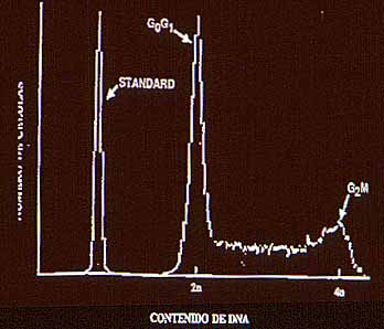 Fig. 1. Imagen tipo histograma en un tejido normal